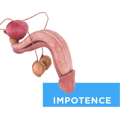 Marie Manga Impotency Supplement